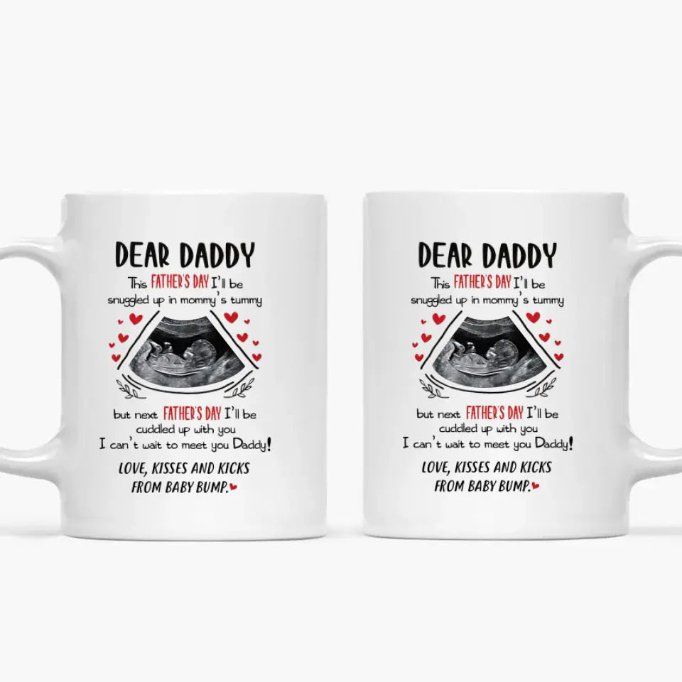 Personalized White Mug - Father's Day Gift For Dad - Dear Daddy ARND036
