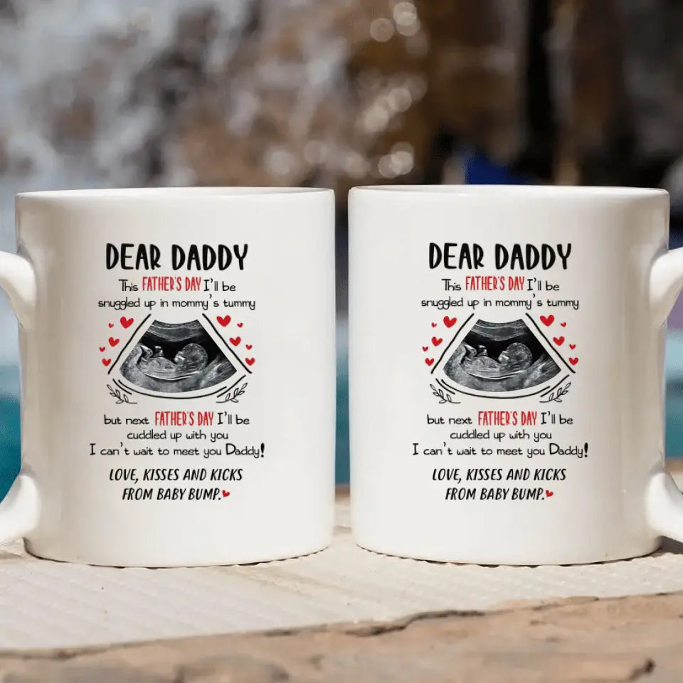Personalized White Mug - Father's Day Gift For Dad - Dear Daddy ARND036